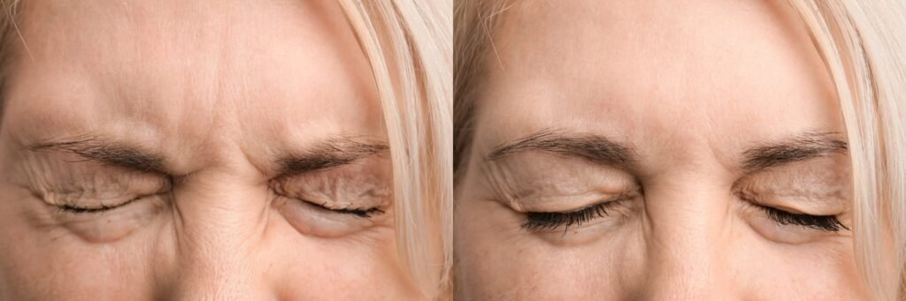 Anti-Aging Skin Treatments in Kakinada & Rajahmundry